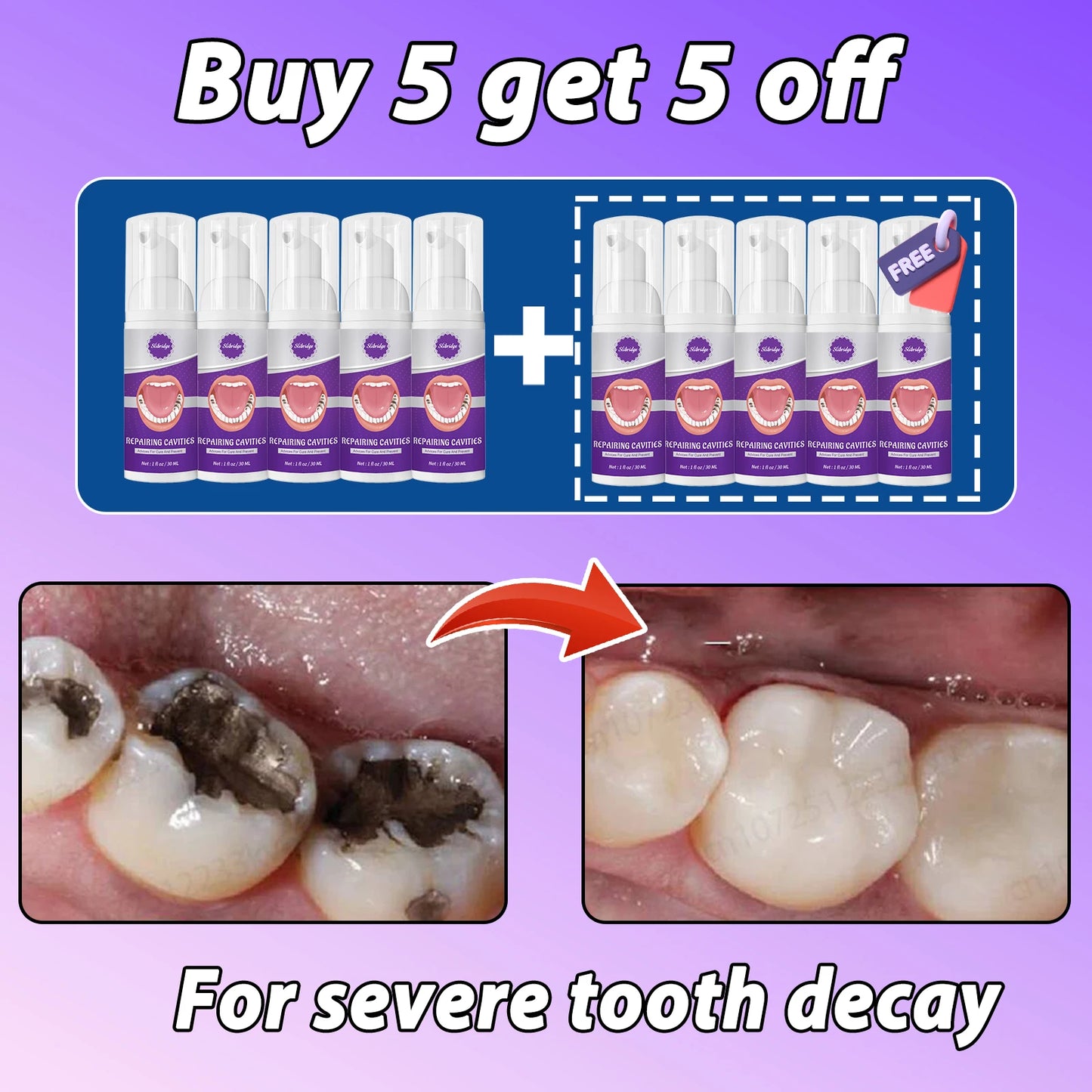 Tooth Decay Repair Solution Paste