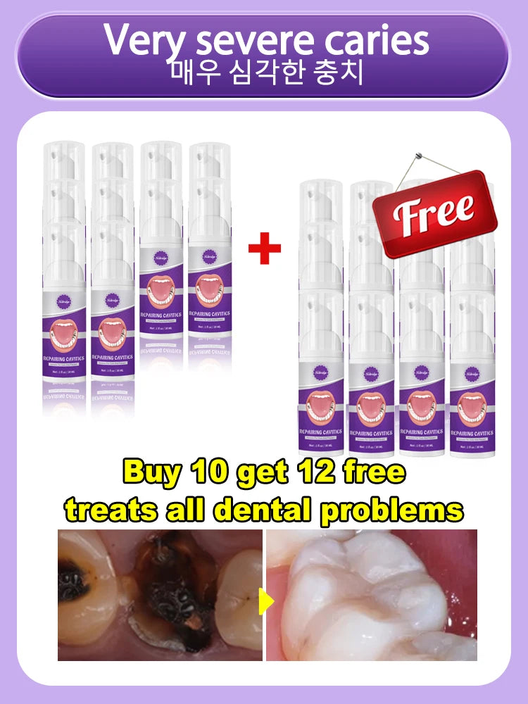 Tooth Decay Repair Gel Paste