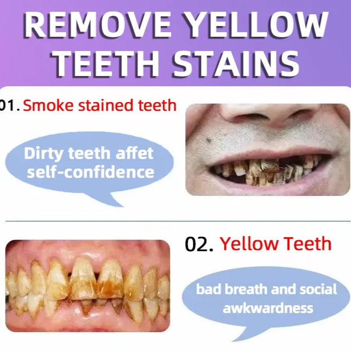 Tooth Decay Repair Solution Paste
