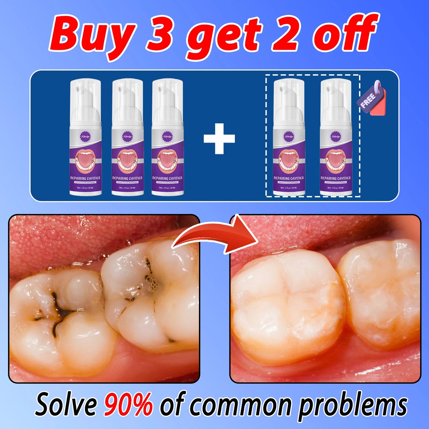 Tooth Decay Repair Solution Paste
