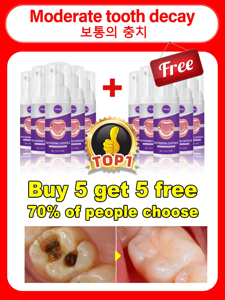 Tooth Decay Repair Gel Paste