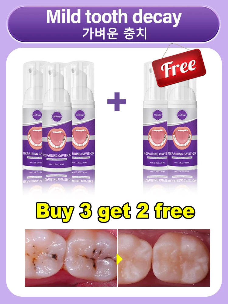 Tooth Decay Repair Gel Paste