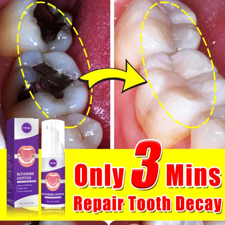 Tooth Decay Repair Gel Paste