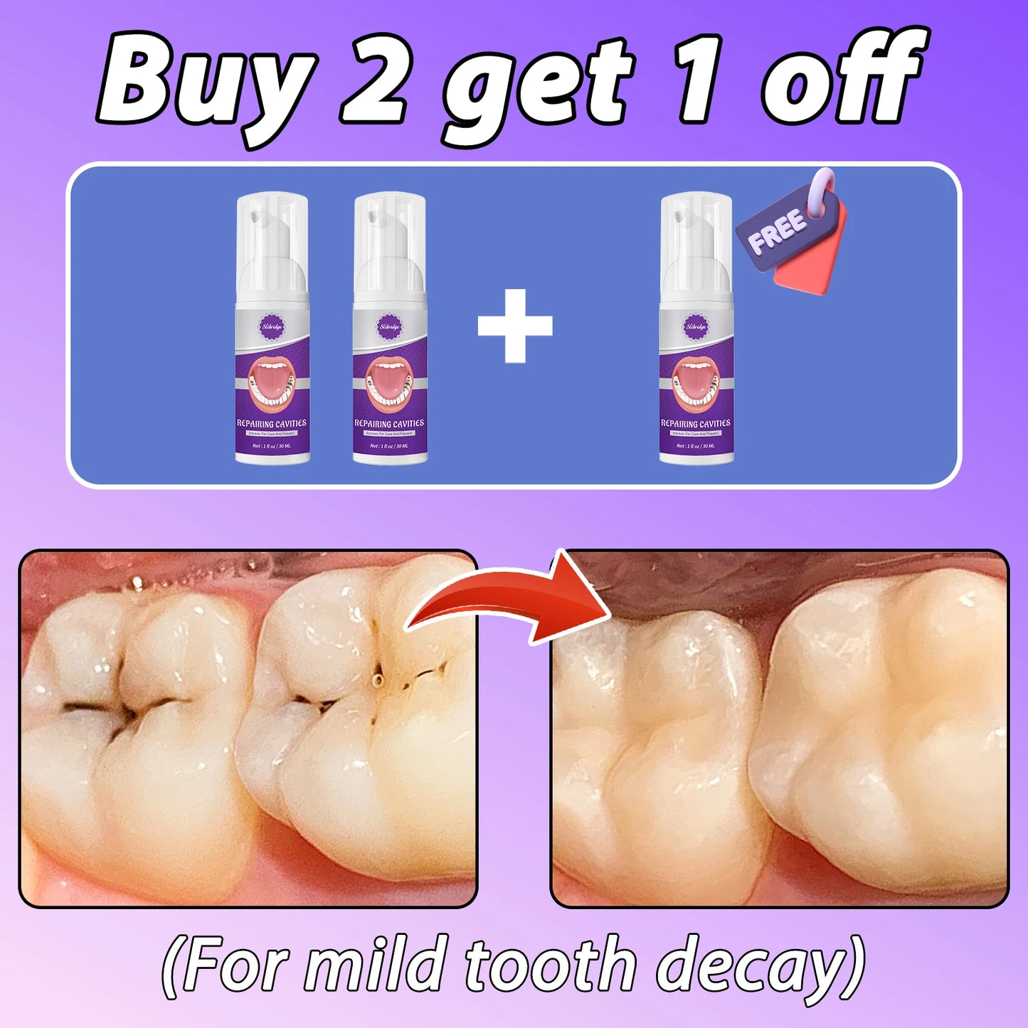 Tooth Decay Repair Solution Paste