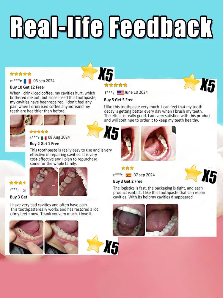 Tooth Decay Repair Gel Paste
