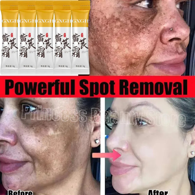 Powerful Spot-removing Whiten Cream