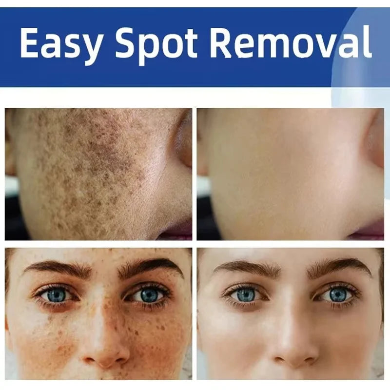 Powerful Spot-removing Whiten Cream