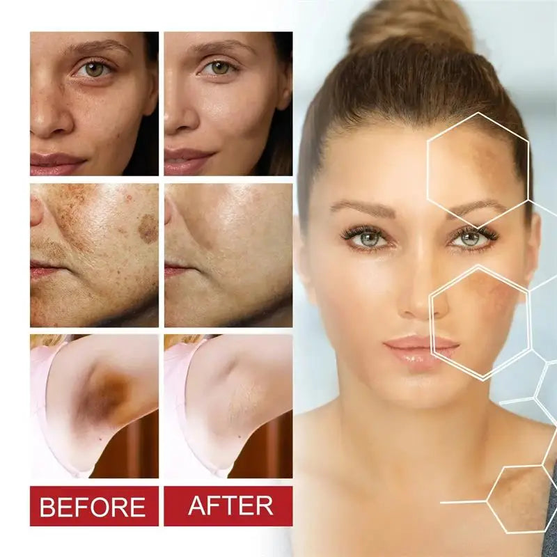 Powerful Spot-removing Whiten Cream